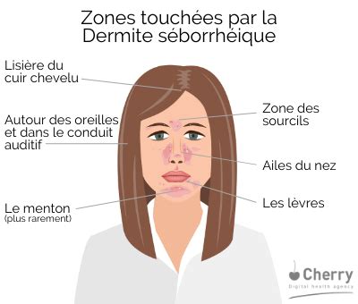 Localisation des zones affectées par la dermite séborrhéique