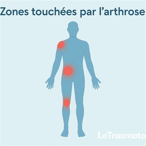 Infographie montrant les zones du corps du chien les plus souvent touchées par les rougeurs (plis, pieds, babines)