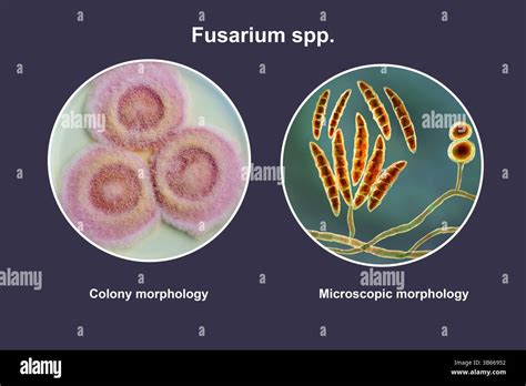Champignons Fusarium sp. sur substrat