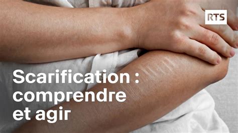 Illustration montrant deux passages croisés pour une scarification efficace