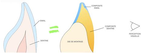 Comparaison visuelle entre une dent neuve et une dent usée