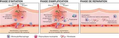 Schéma explicatif de la réaction de photosensibilisation cutanée