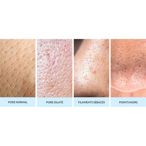 Schéma illustrant l'action purifiante et astringente de l'hydrolat sur les pores de la peau
