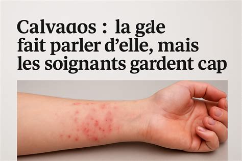 Photo macro montrant les symptômes de la gale bactérienne sur le bois