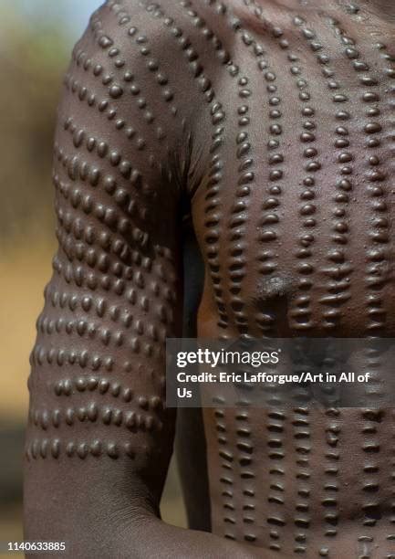 déclin de la scarification