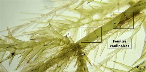 La sphaigne au microscope
