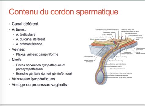 Diagramme illustrant les deux points d'écrasement sur le cordon testiculaire avec l'espace non écrasé