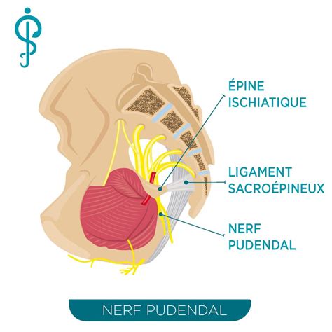 Diagramme illustrant l'emplacement du nerf pudendal dans le bassin et les zones de douleur associées