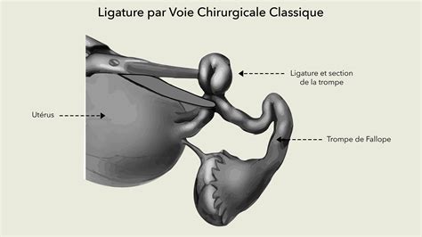 Schéma illustrant la technique de ligature en spirale autour d'une branche de genévrier