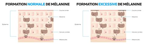 schéma illustrant la formation de la mélanine dans l'épiderme