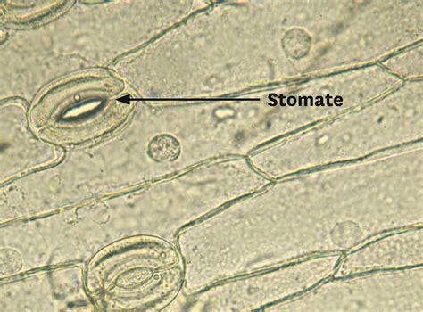 Photographie au microscope optique d'un stomate ouvert sur une feuille