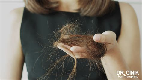 Thérapies pour la perte de cheveux