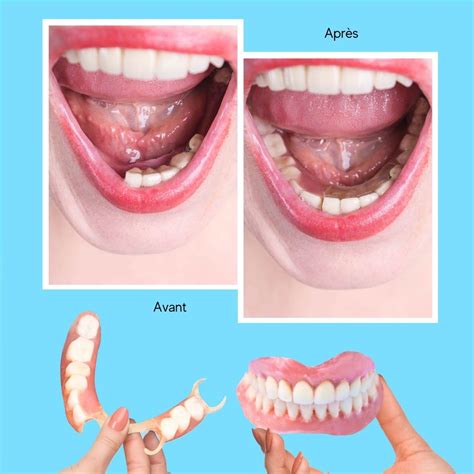 Photo comparative entre une dent usée (arrondie) et une dent correctement affûtée