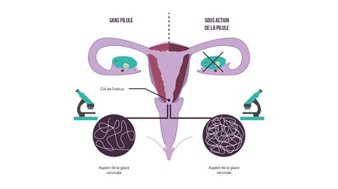 schéma explicatif du mode d'action de l'acide pélargonique