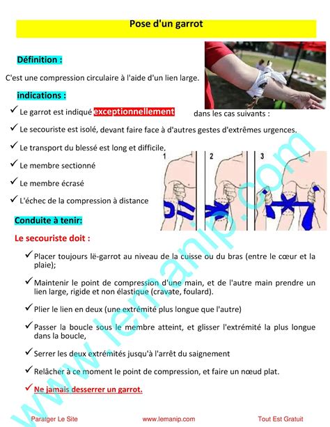 Schéma montrant les points de compression et la pose correcte d'un garrot avec un garrot tourniquet