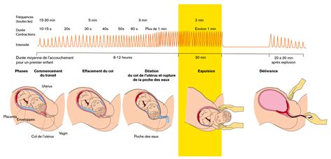 Schéma des trois étapes de l'accouchement