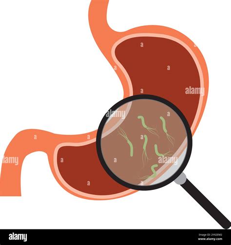 Illustration de la bactérie Helicobacter pylori dans l'estomac