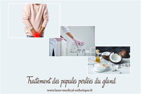 Pénis avec des papules perlées