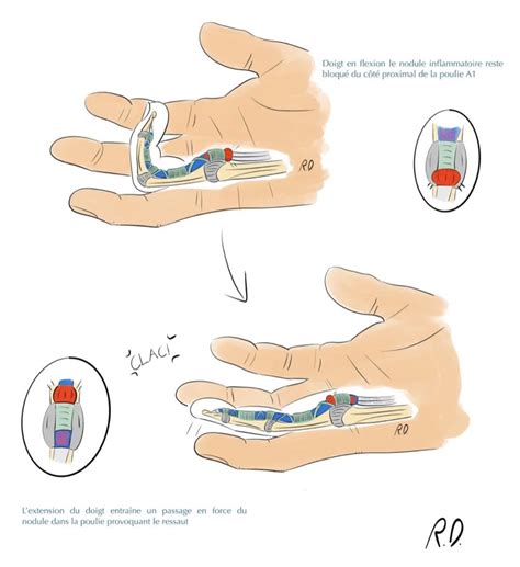 Schéma illustrant la technique du test du doigt dans le terreau