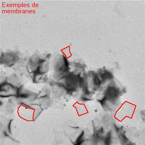 Exemple d'image de microscopie