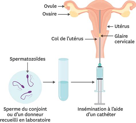 Vue d'ensemble de l'insémination artificielle bovine