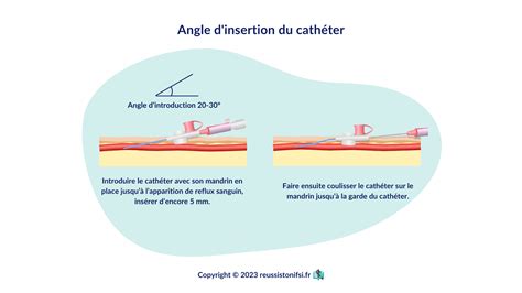 Illustration montrant l'angle correct d'insertion des lames dans le sol lors de la scarification