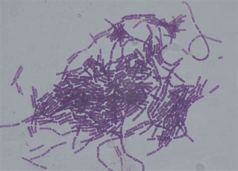 Microscopie électronique de Bacillus thuringiensis