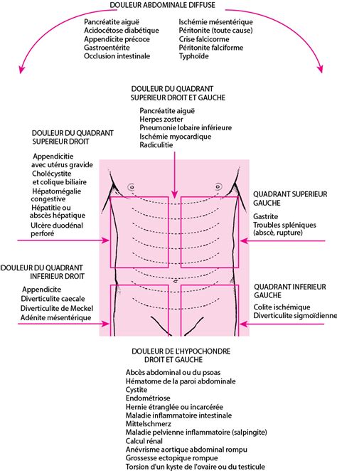 Localisation des saignements gastro-intestinaux