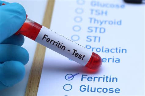 Causes d'une ferritine élevée