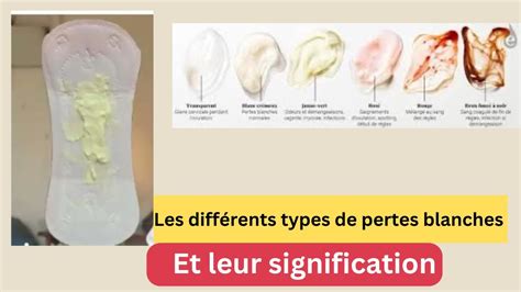 Infographie sur les différents types de pertes post-récolte
